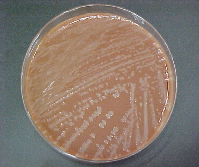 Bacterial Infections of the Respiratory Tract · Microbiology