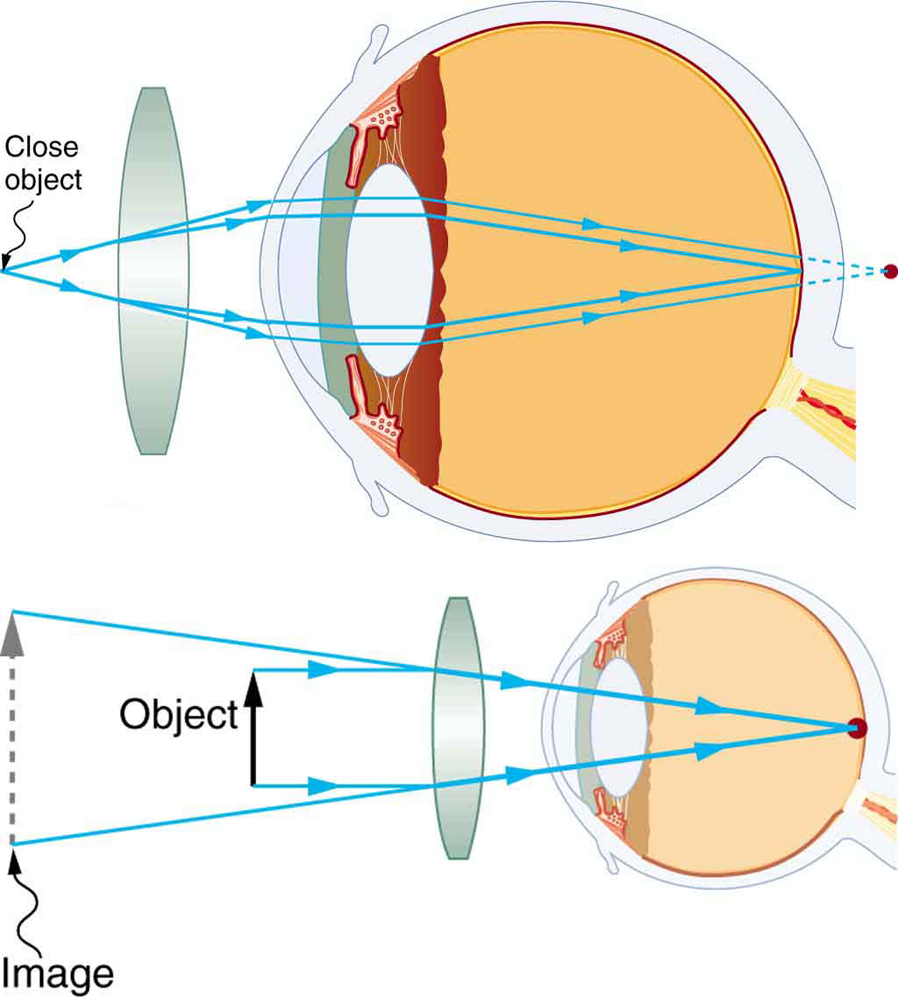 Vision Correction · Physics