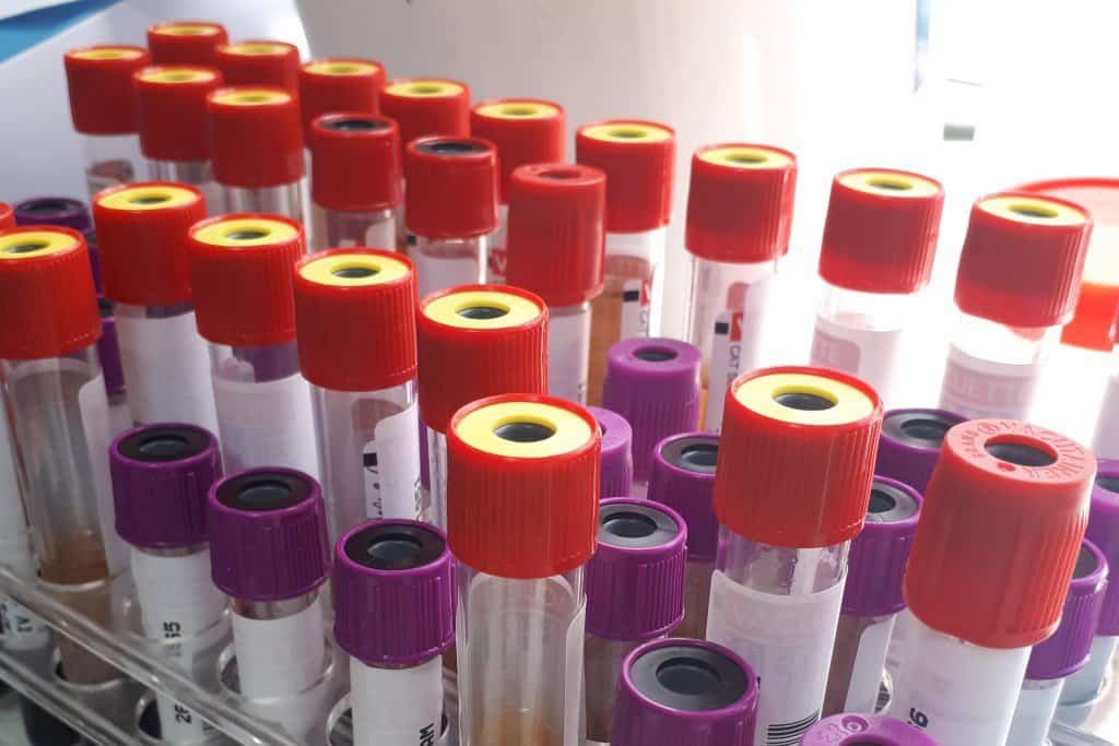 How Much Blood Is Drawn For A Blood Test? Phlebotomist Report