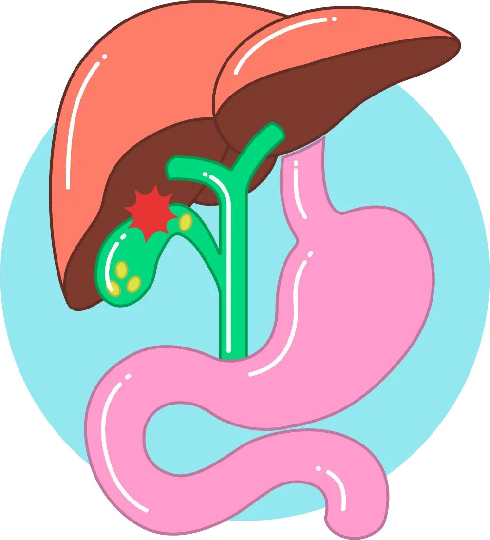 Gallbladder phorma