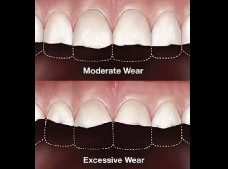 Treatment PH Prosthodontics