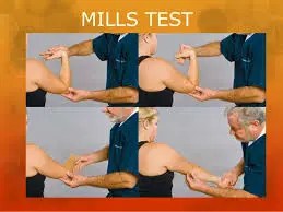 Elbow Examination - Special Tests and Maneuvers