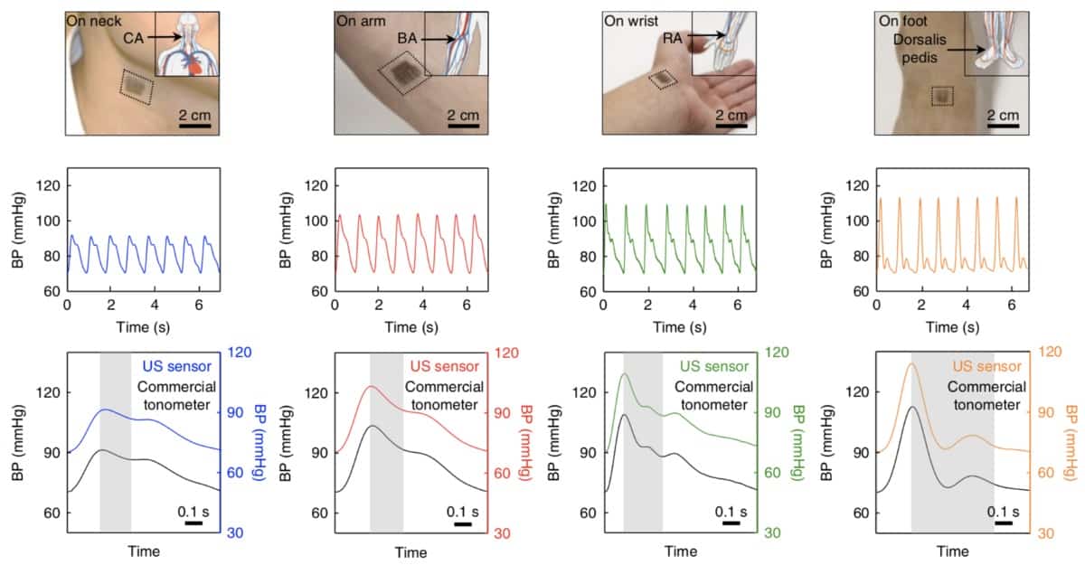 Wearable patch measures central blood pressure Physics World