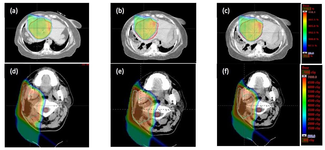 Mobile CT scanner lines up for adaptive proton therapy Physics World