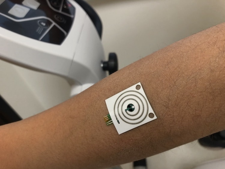 Silkbased sensor analyses sweat biomarkers in real time Physics World