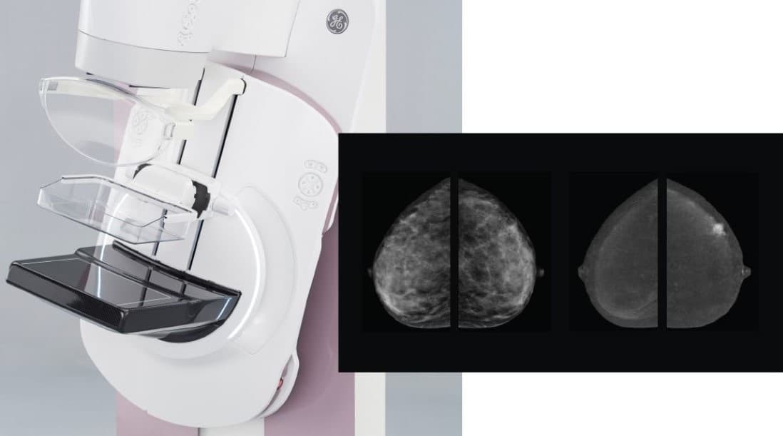 Simple, routine QA enhances contrastenhanced mammography Physics World