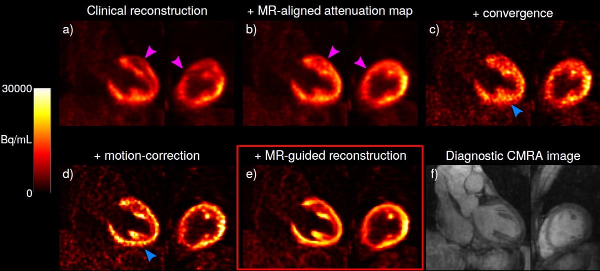 Simultaneous PETMR imaging could improve the diagnosis of heart