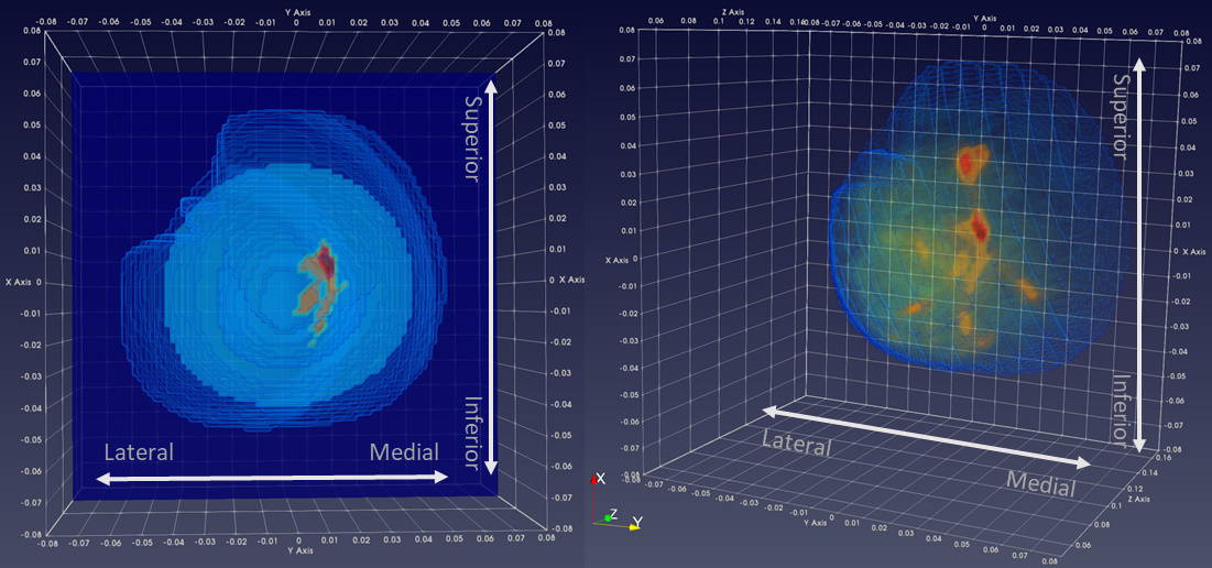 Microwave imaging could provide safer, more comfortable breast cancer
