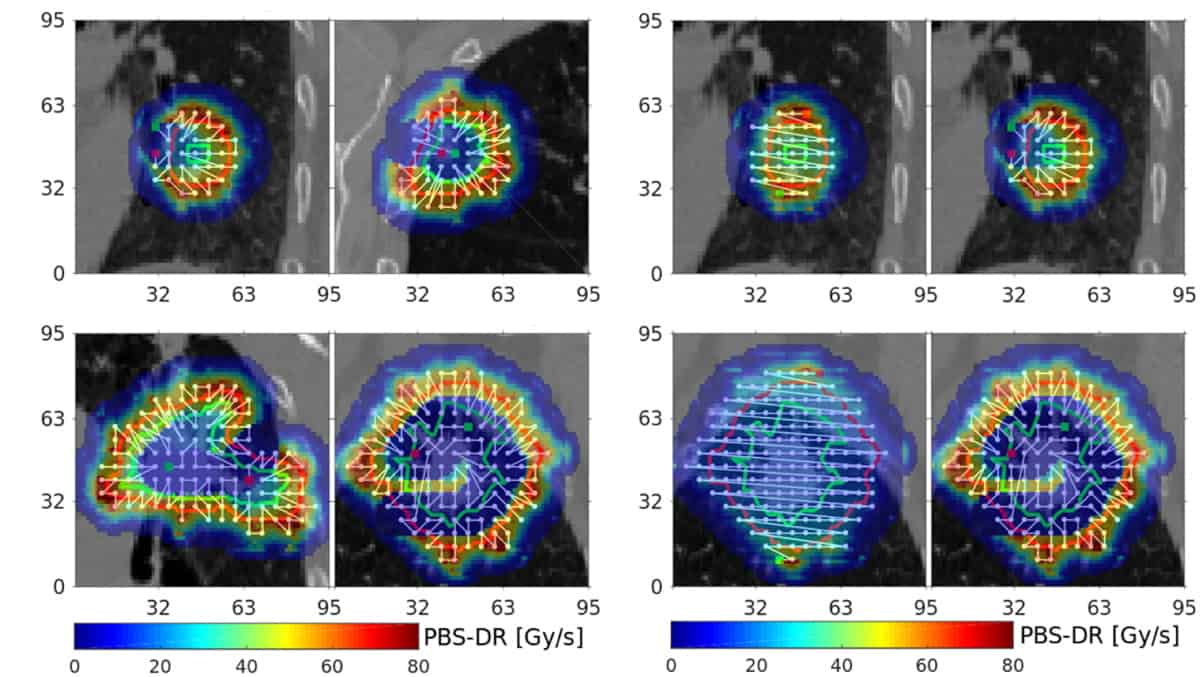 Optimized pencilbeam delivery patterns enhance FLASH proton therapy