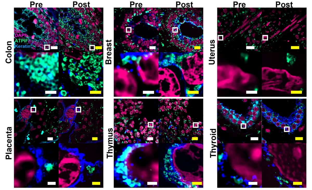 Expansion microscopy enables nanoimaging with a conventional microscope