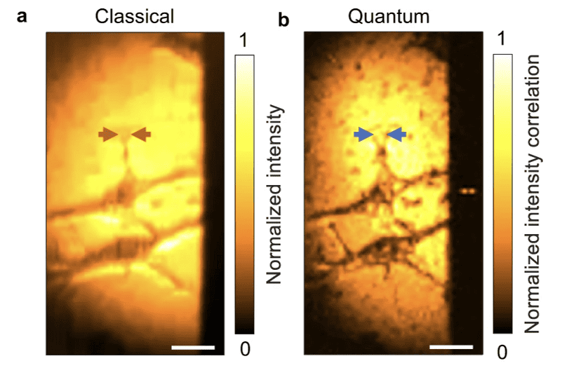 Quantum entanglement doubles microscope resolution Physics and Maths