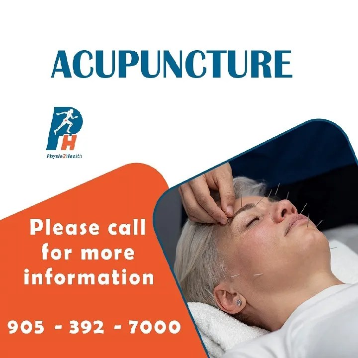 ACUPUNCTURE IN RICHMOND HILL Best Benefits of Acupuncture physio2health