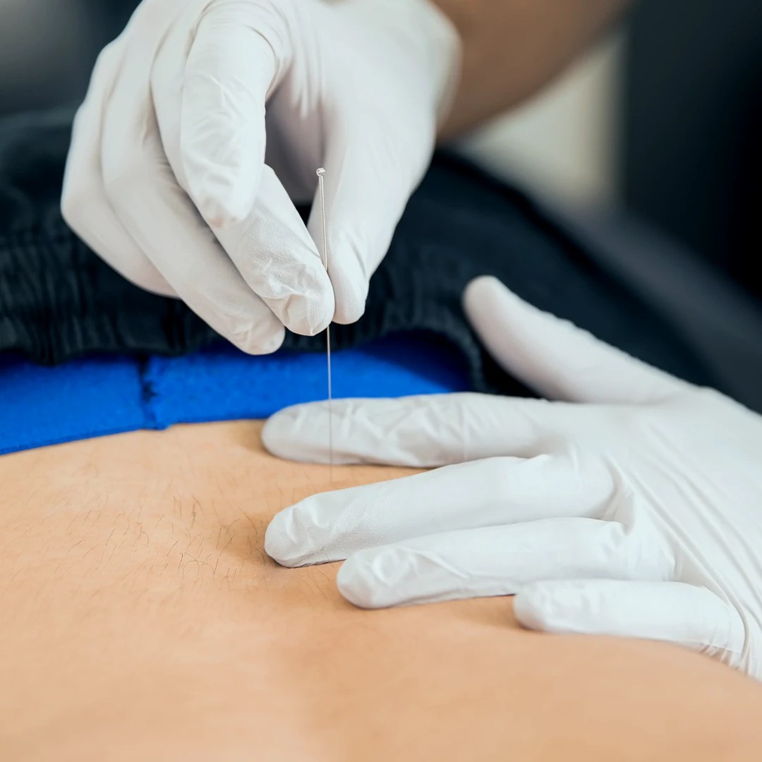 PhysioEdge Physical Therapy and Sports Performance Physical Therapy