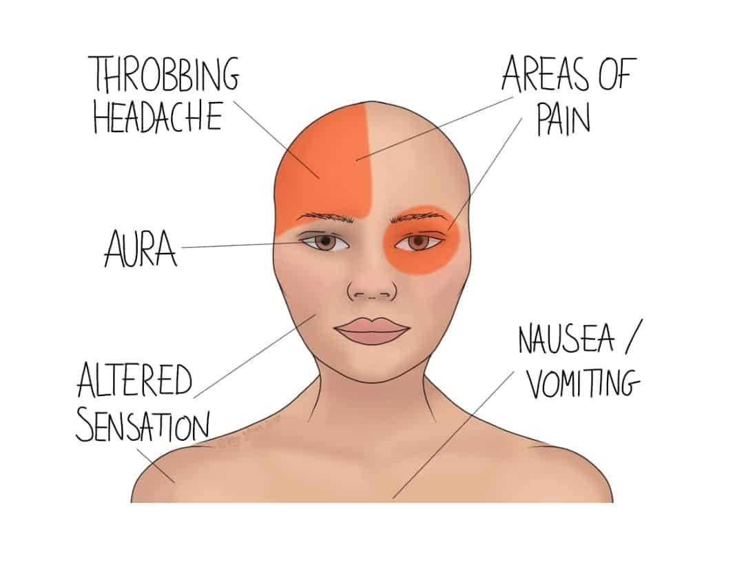 Migraines And Headaches