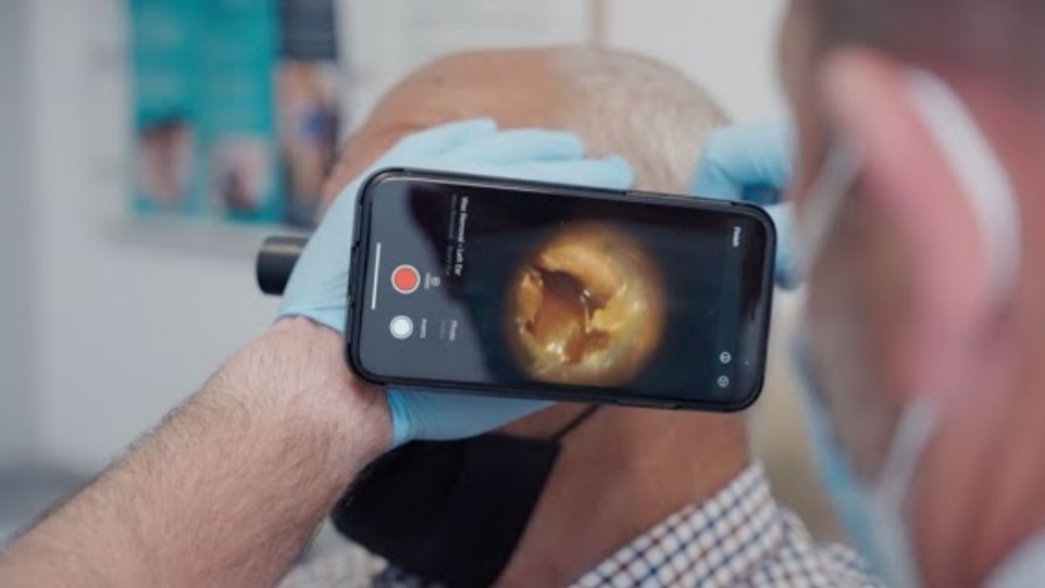 Ear Wax Removal In Yate