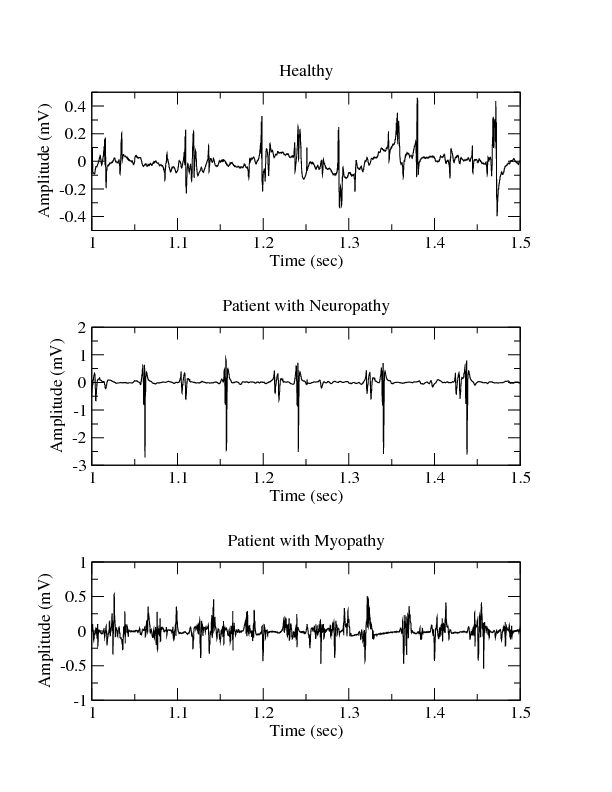 Examples of Electromyograms v1.0.0