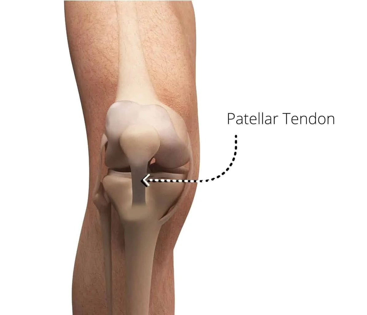 Pain Below Knee Cap? Learn 8 Patellar Tendonitis Exercises for Quick