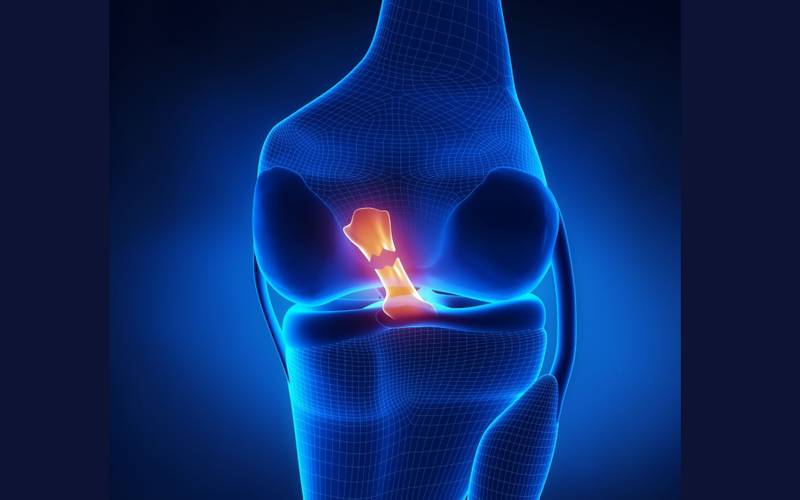 Symptoms of a Torn ACL, What to do at Home