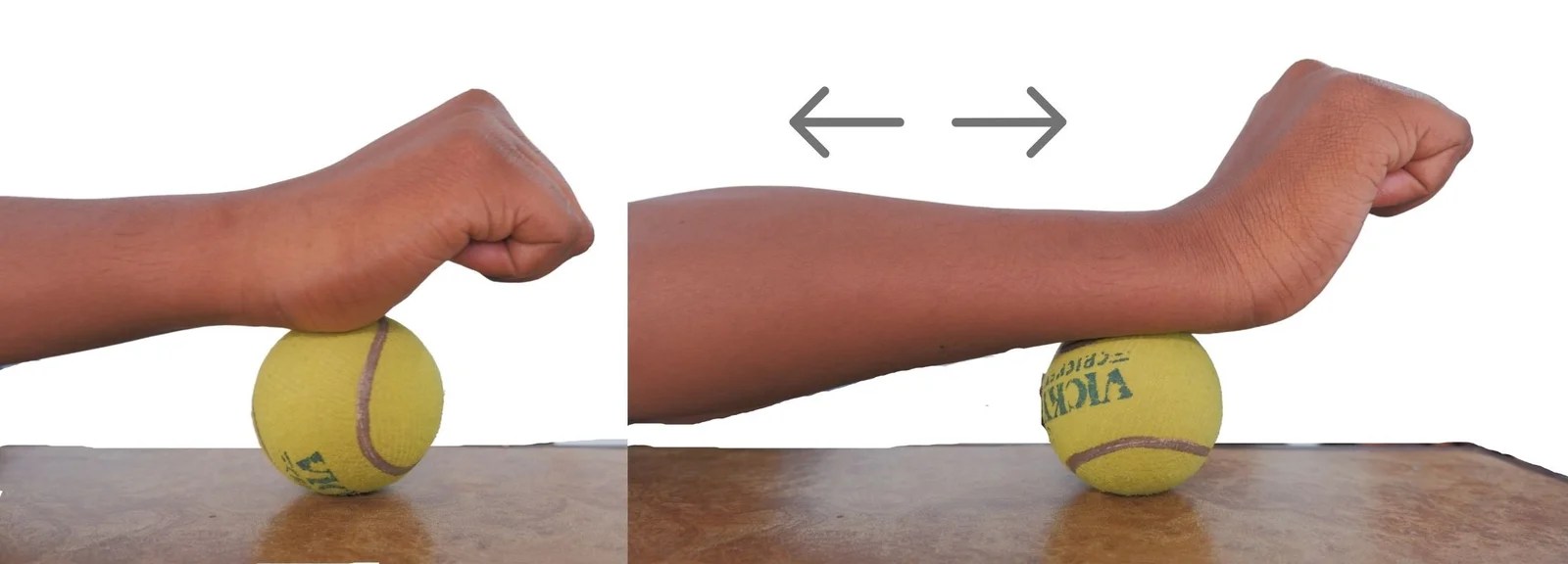 5 Best exercise for carpal tunnel wrist pain, causes & symptoms