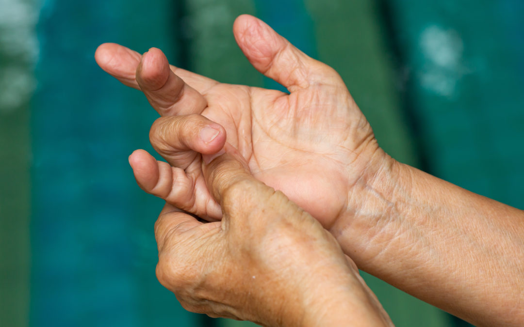 Trigger Finger Clicking, Locking, or Painful Finger Physiovive