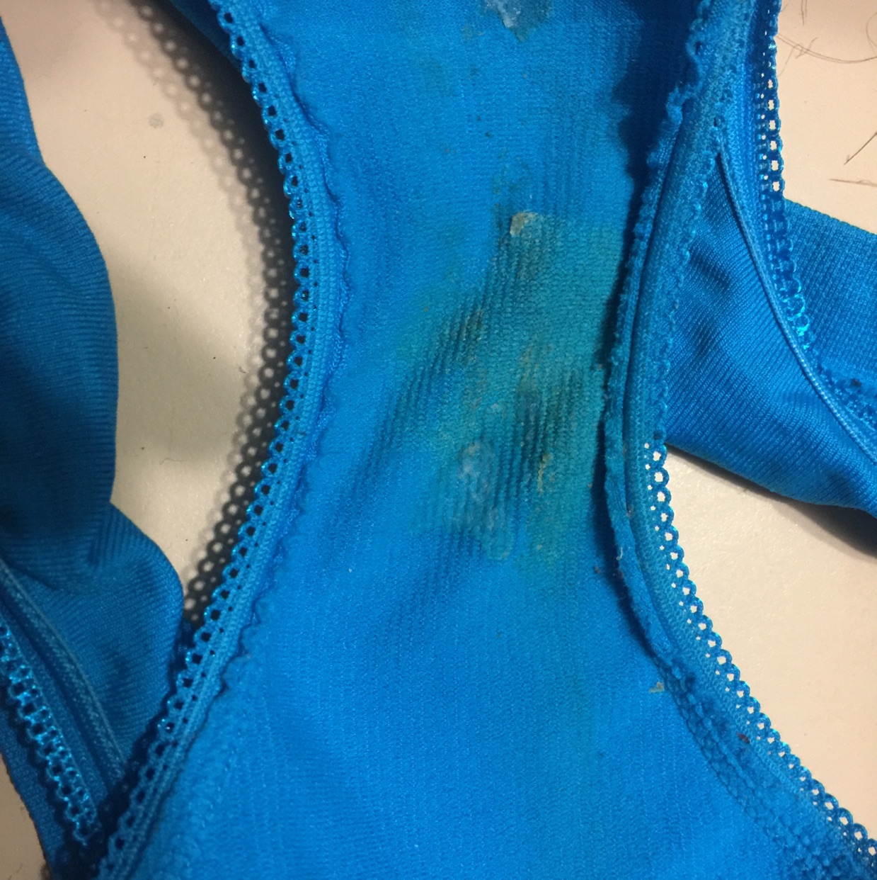 Greenish Yellow Discharge Men