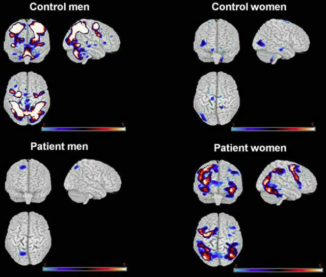 Transgender brain structure? Glow Community