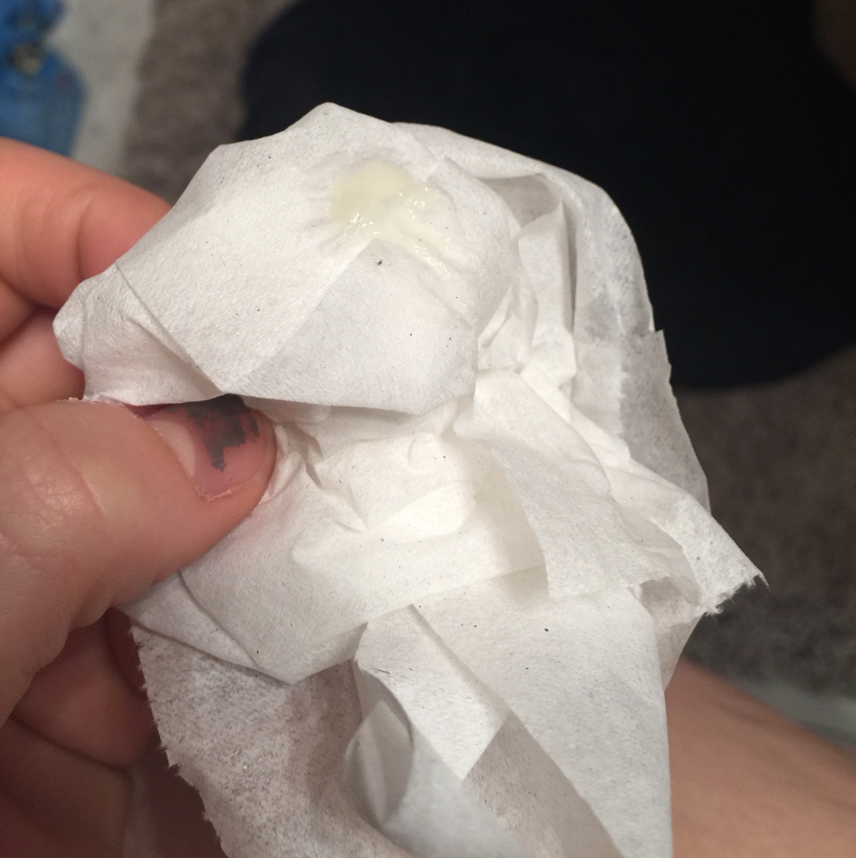 So I went pee, checked my cervix and got this big glob of yellowy