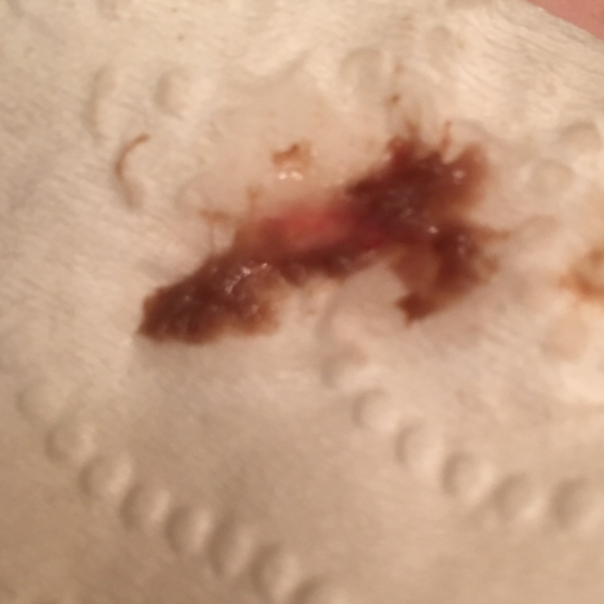 Could implantation bleeding look like this? Sometimes af starts similar