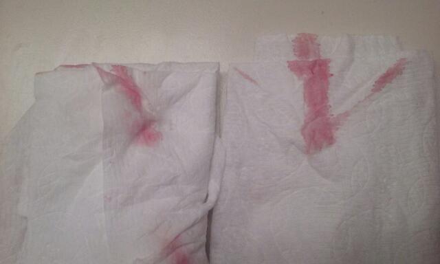 Does this look like implantation bleeding or AF . I'm not due for my