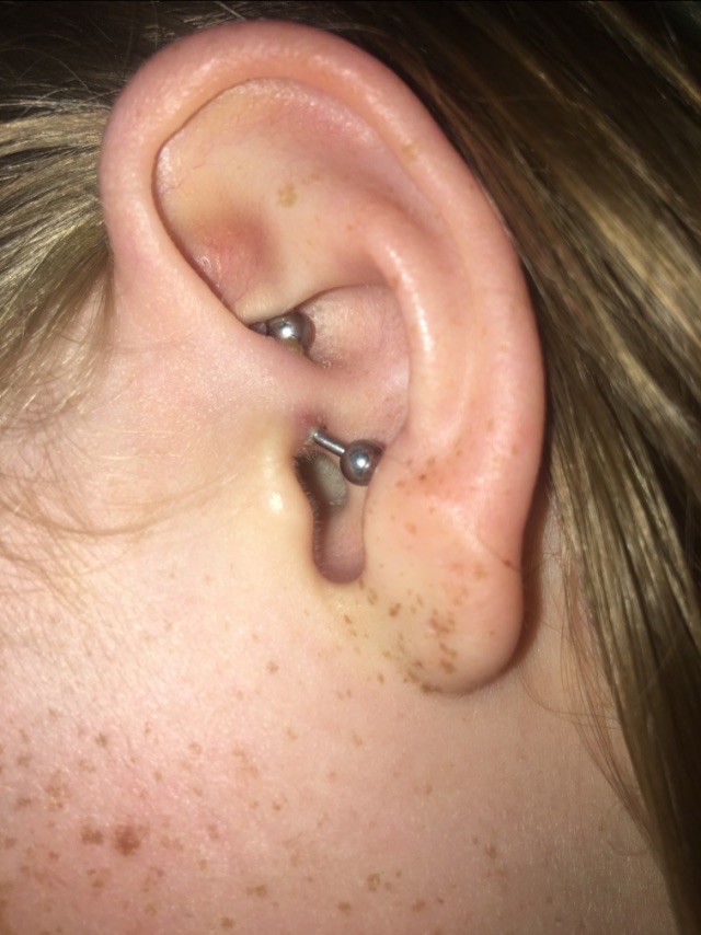Daith Piercing Healing Bump Verzameling