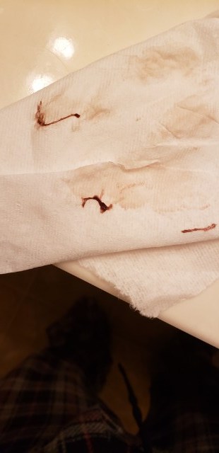 Implantation bleeding? Glow Community