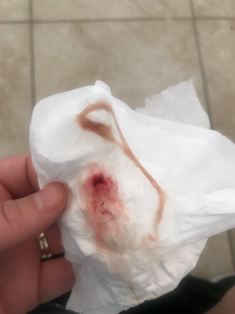 Implantation Bleeding?? - Glow Community