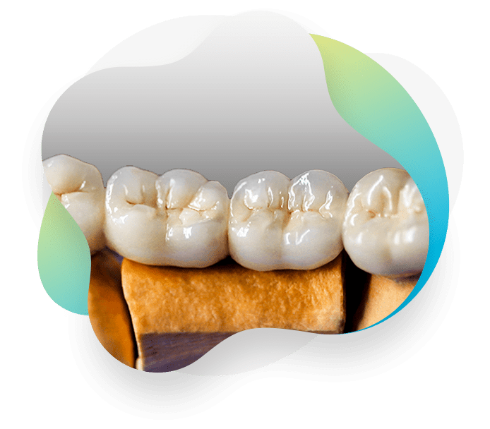 Crown & Bridge Picasso Dental Studios