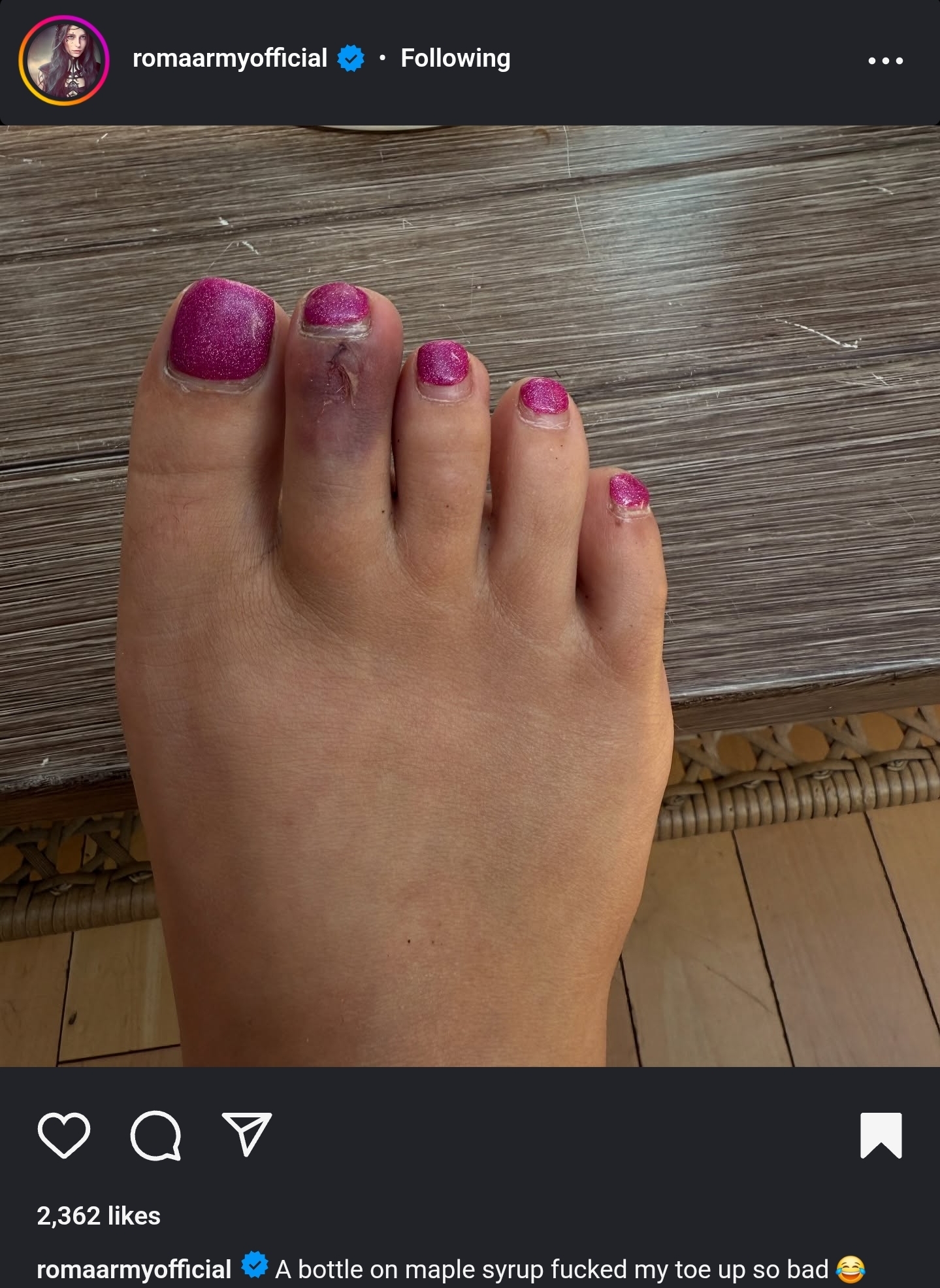 Chloe Roma's feet(07)