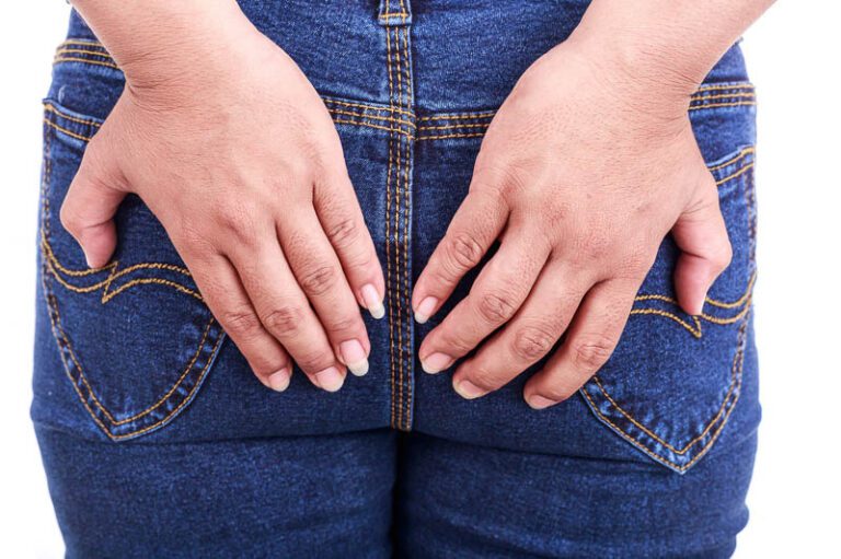 Treating Early Pilonidal Disease Evergreen Surgical Pilonidal Clinic