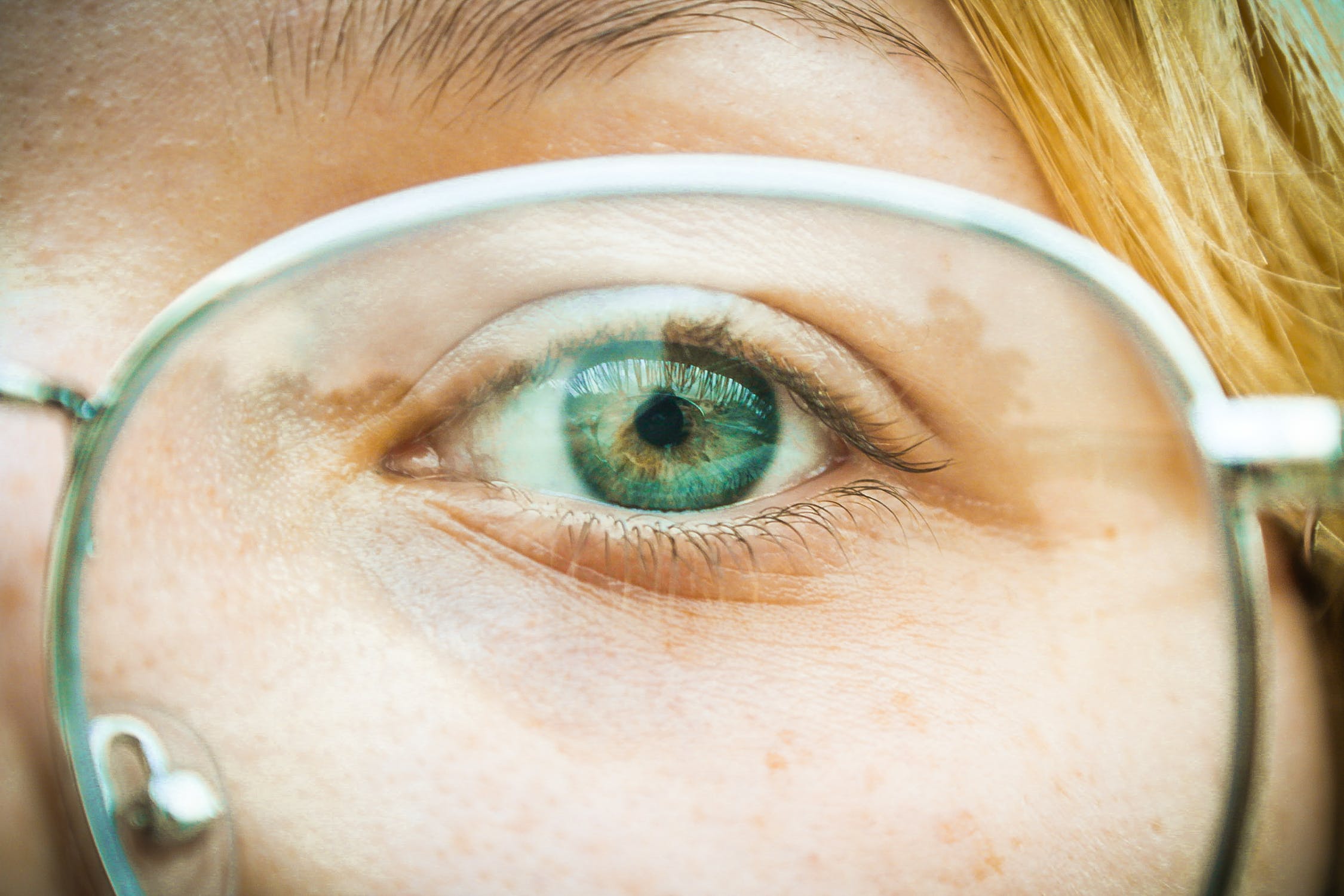 What Is Anisometropia and What Can You Do About It? Lazy Eye Syndrome