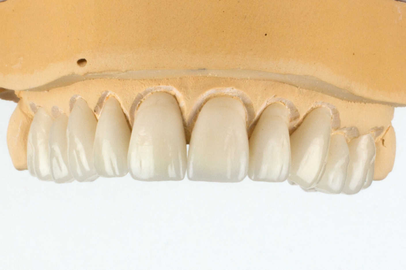 Dental Laboratory Products Dental Lab Products Online