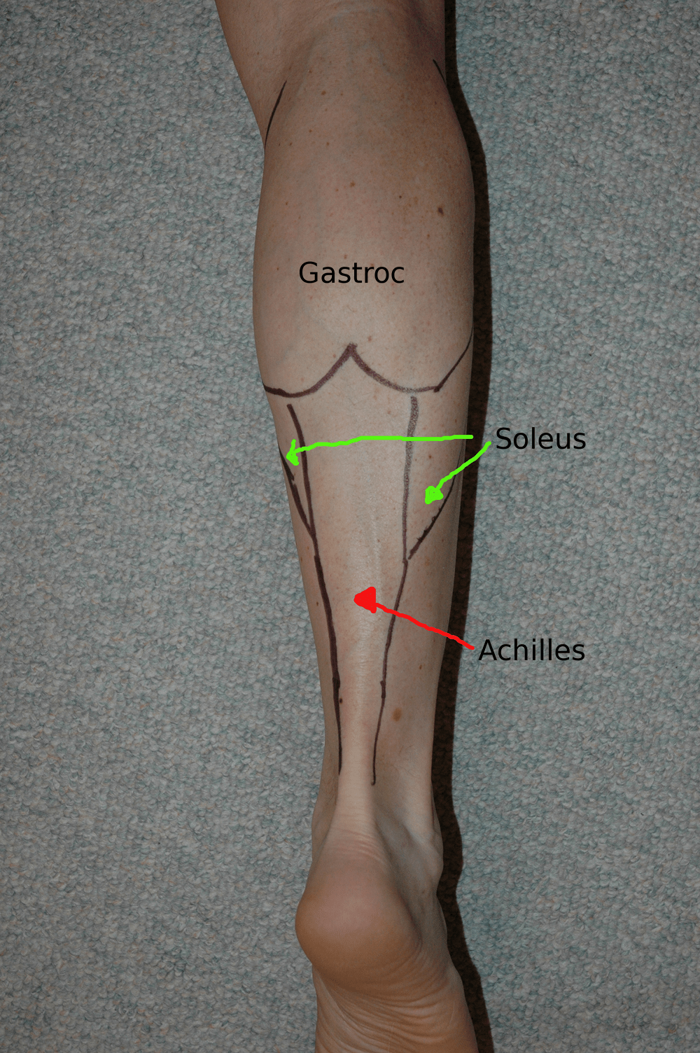 Self Muscle Massage, pt 2 the Calf Pinnacle Physical Therapy