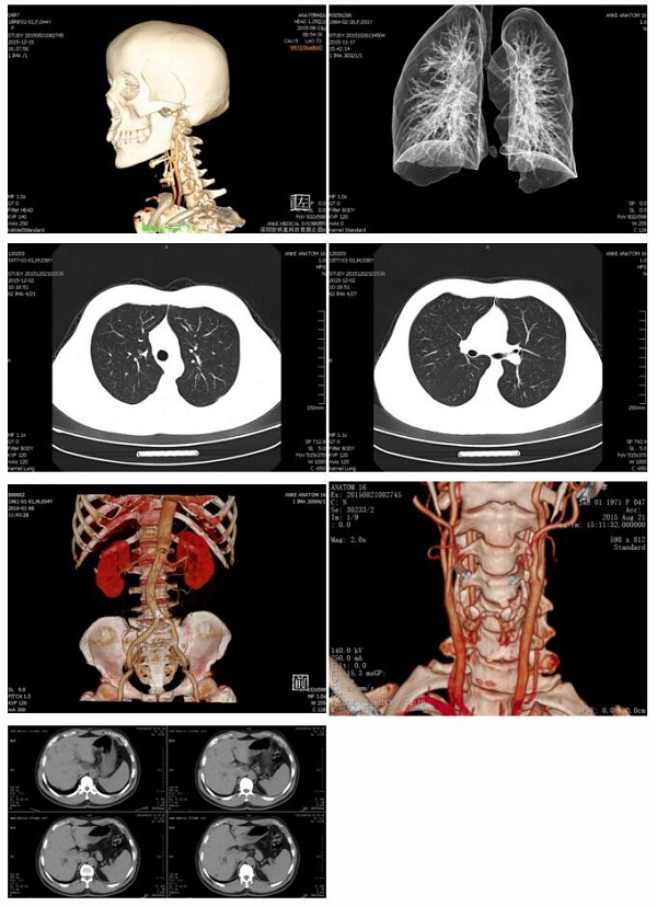 Anatom16 Multislice Helical CT Scanner