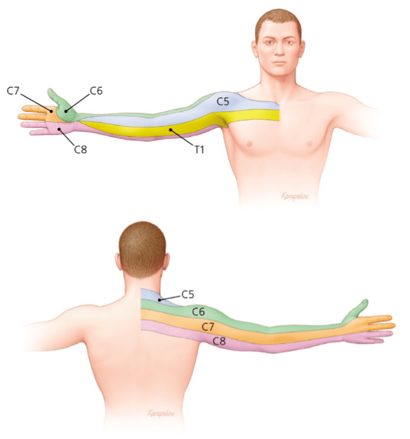 Cervical Radiculopathy Physiotherapy