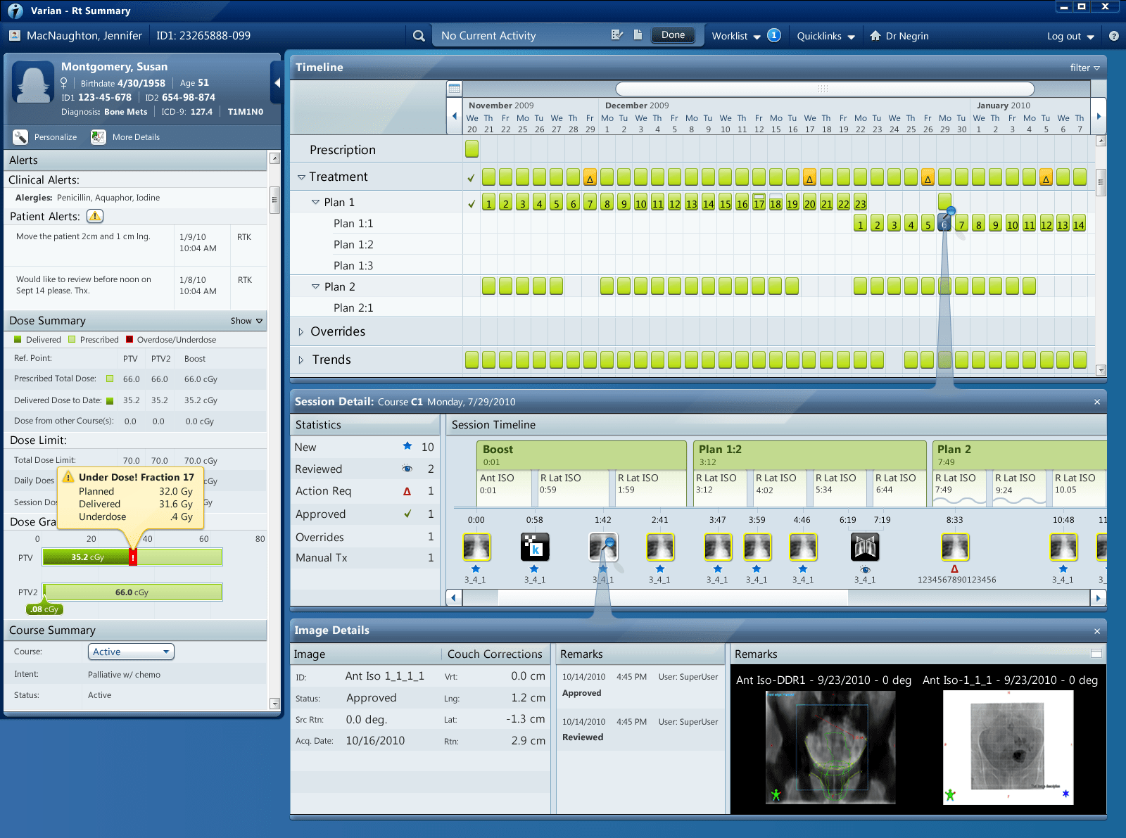 Varian Medical Systems India Software Pvt Ltd at James Rameriz blog