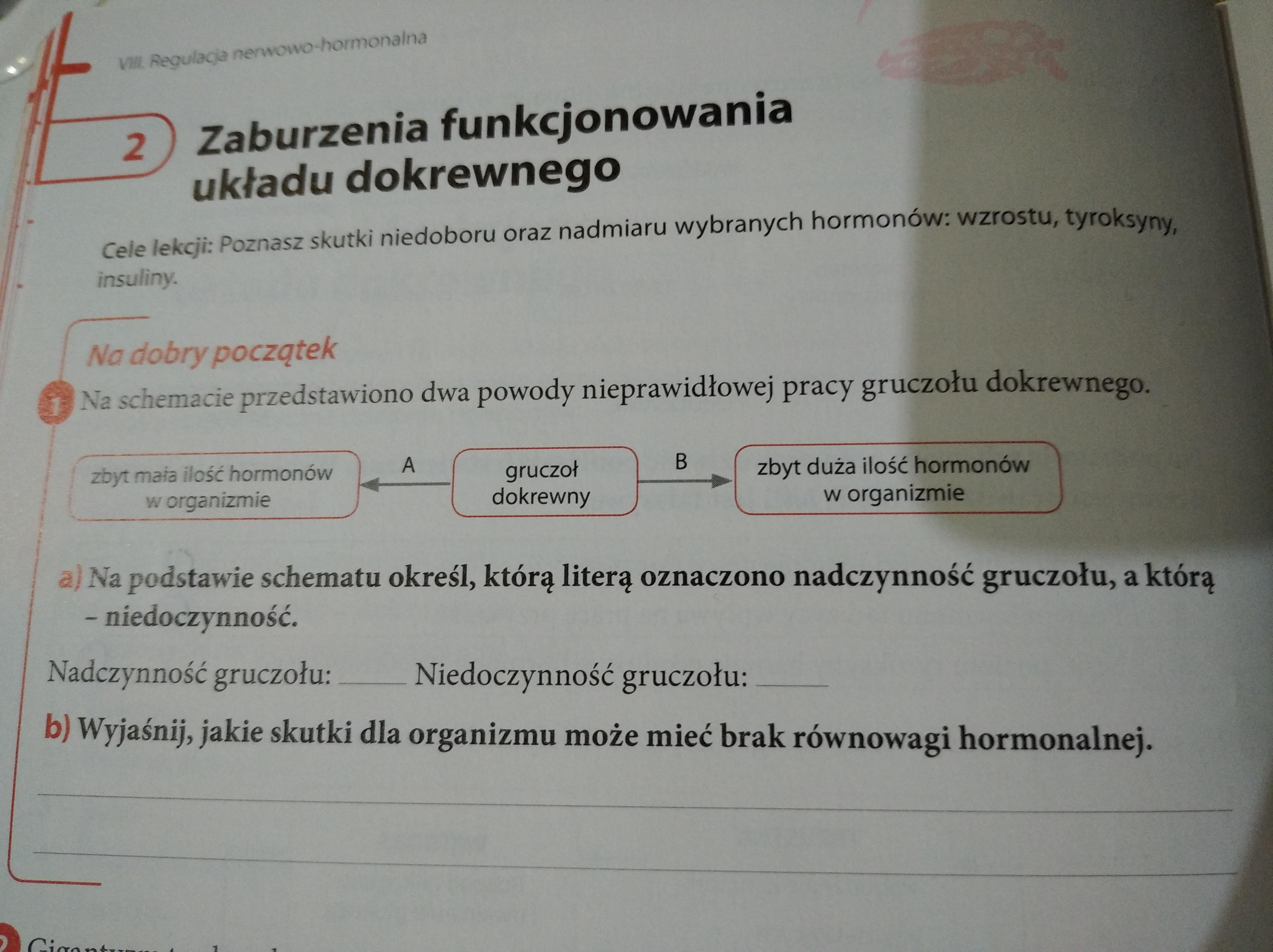 Na schemacie przedstawiono dwa powody nieprawidłowej pracy gruczołu