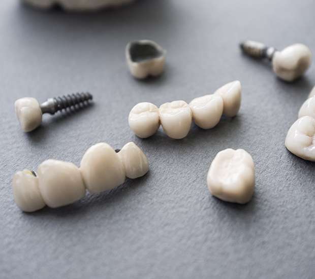 Difference Between Dental Implants & Mini Dental Implants Plainview