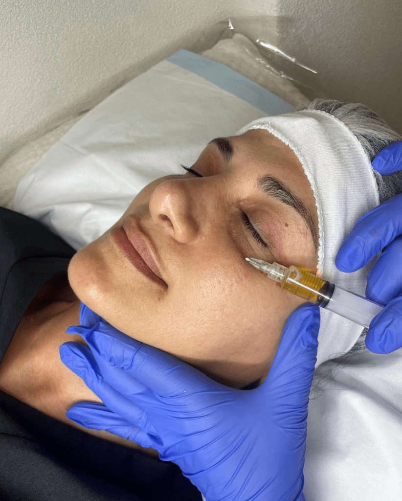 PRP Under Eye Treatment Professionals in Melbourne Plasma Therapy