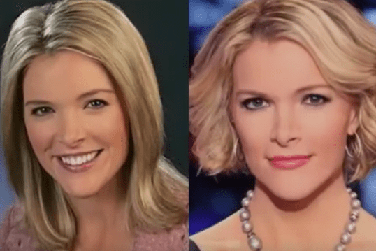 Megyn Kelly Plastic Surgery, Breast Implants Before and After Plastic