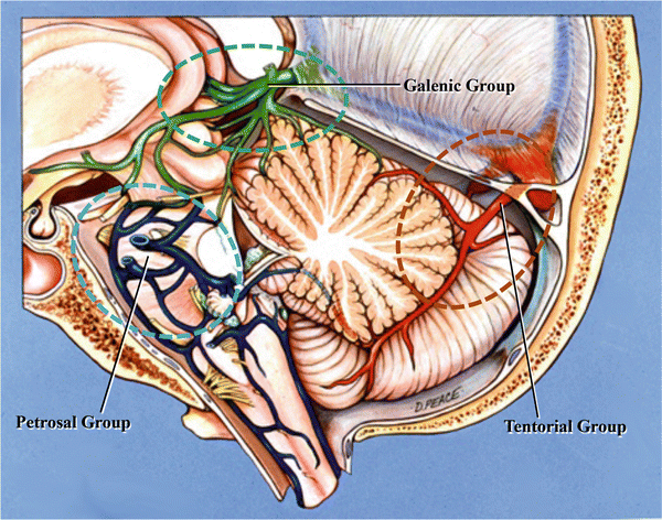 The “Rules of Three” in the Posterior Cranial Fossa | Plastic Surgery Key