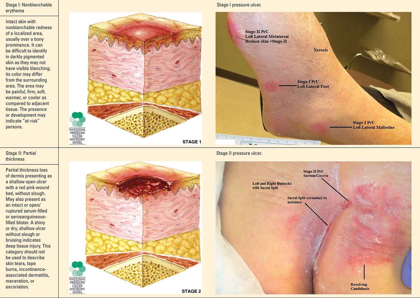 Wound Care Plastic Surgery Key