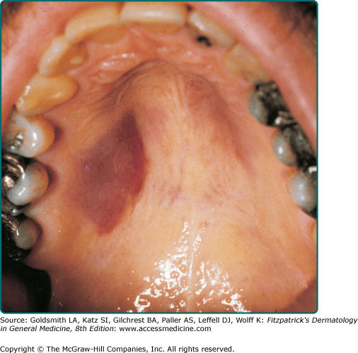 Kaposi’s and Plastic Surgery Key
