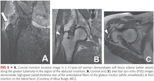 Arthroscopy Plastic Surgery Key