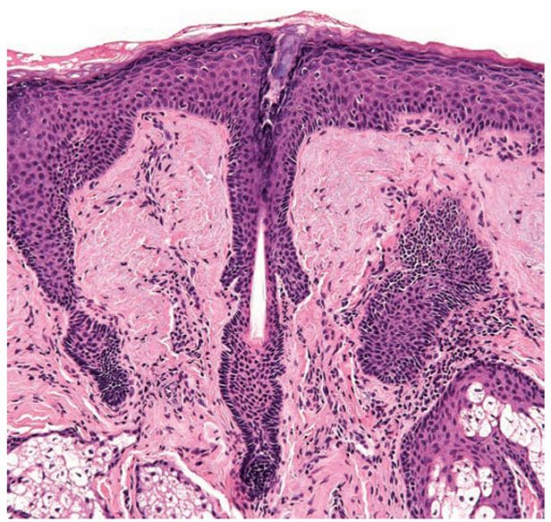 Histology of the Skin Plastic Surgery Key